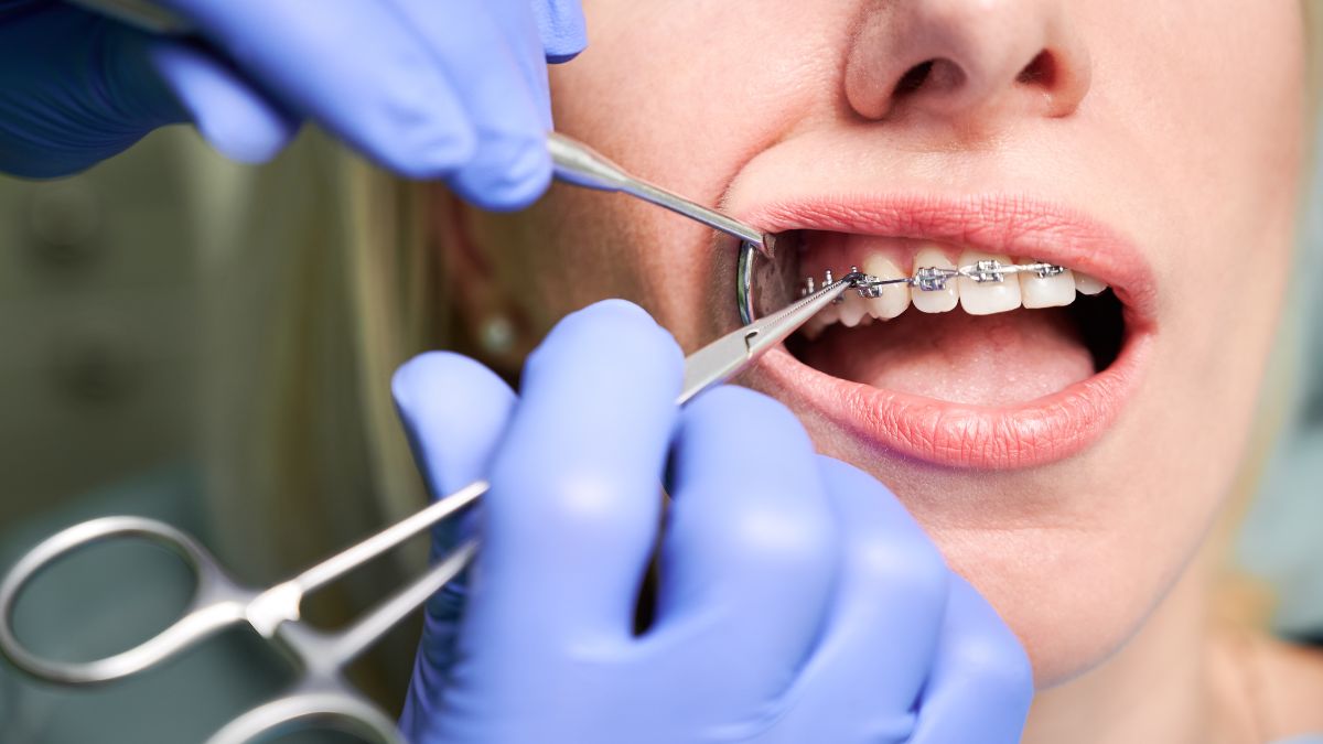 Is Going to the Dentist in Alanya Safe? Full 2026Guide CertiGo Decision